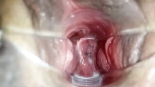 stepsister let me play dr with speculum to see her making grool inside