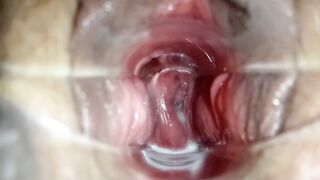 stepsister let me play dr with speculum to see her making grool inside