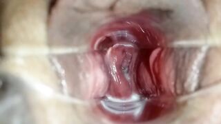 stepsister let me play dr with speculum to see her making grool inside