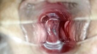 stepsister let me play dr with speculum to see her making grool inside