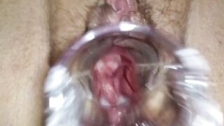 stepsister let me play dr with speculum to see her making grool inside