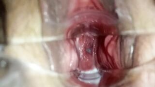 stepsister let me play dr with speculum to see her making grool inside