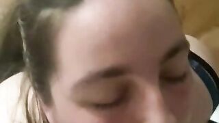Fat load to the face