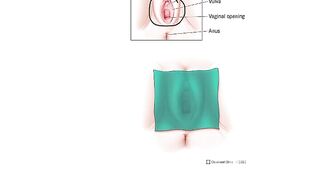 How to Use a Dental Dam